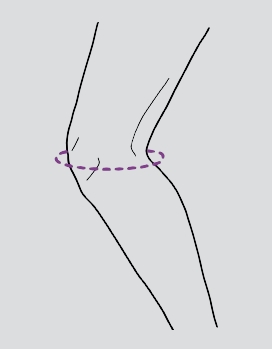 Orteza de genunchi cu suport patelar